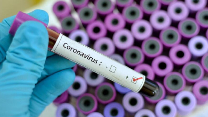 Teste Coronavírus